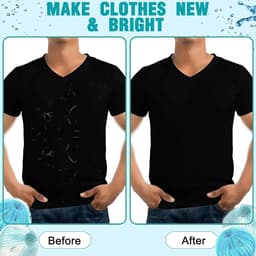 SnelShoppen - Haarverwijderaar voor Wasmachine, Dierenhaar Vanger, Wasballen voor Kat/Dog, Microvezel, 4 Stuks, Beschermt Kleding, Vermindert Kreuken, — thumbnail 3