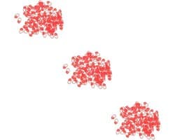 NOLITOY 300 Stuks Markeer Gesp Markeerringen Vergrendeling Clips Steek Naald Clips Haak Veiligheid Flexibele Steekhouders Haak Clips Breien Breinaald Clip Markeerstift Plastic Garen
